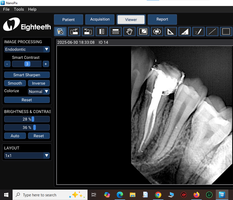 dental x ray in dinajpur dental zone. dr.monjur alam.